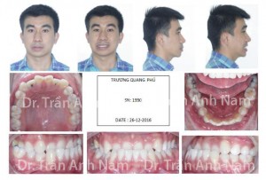 DR Nam0428
